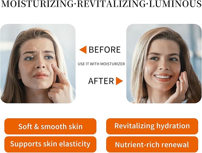 Rose Water Face Toner, Moisturizing & Anti-Aging for All Skin Types (13.5Fl oz)