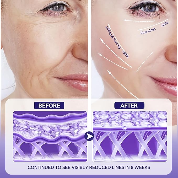 Peptides Serum with Hyaluronic Acid for Fine Lines and Wrinkles, Collagen Boosting Hydrating Serum, Anti-aging for All Skin Types, Fragrance Free, 1.35 Fl. Oz