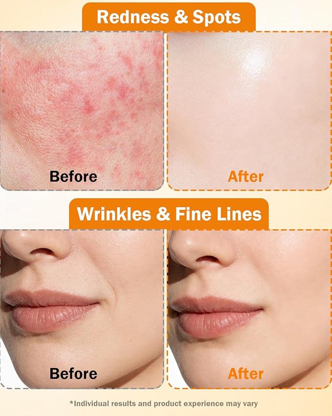 Super Vitamin C Serum for Face | Natural Anti-Aging Formula with Vitamin C, Hyaluronic Acid, Vitamin E & Caffeine - Firming Serum for Hydration, Wrinkle Reduction & Dark Spot Brightening - 1 Fl Oz