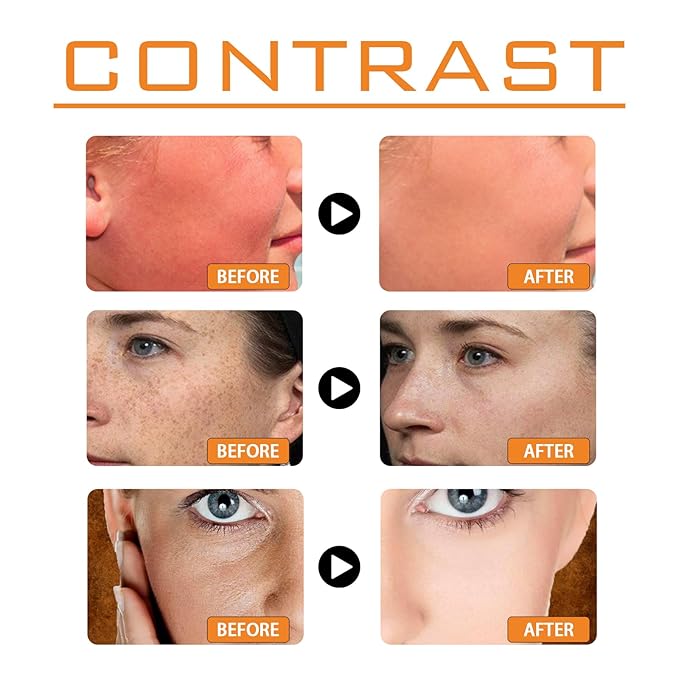 Antioxidant-Infused Sunscreen SPF 100 Broad Spectrum, Face & Body Oil-Free Oxybenzone-Free, Designed for Sun Sensitive Skin