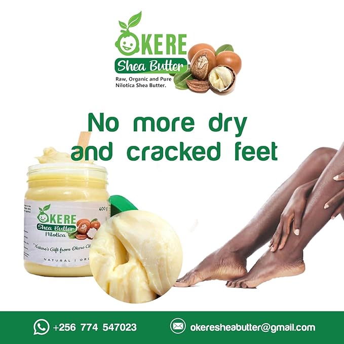 Okere Nilotica Shea Butter | Raw & Pure from Uganda | 08 OZ JAR