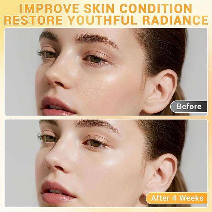 23% Vitamin C Serum - Vitamin E & Hyaluronic Acid Blend - Hydrating & Skin-Improving Formula, Reduces Wrinkles/Fine Lines, Evens Skin Tone - Gentle for All Skin Types, Promotes Smooth, Radiant Skin