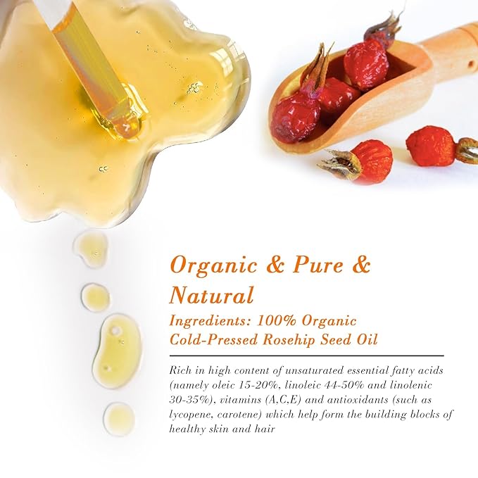 Organic Rosehip Oil for Face & Skin – USDA Certified, Cold Pressed, Unrefined Rose Hip Seed Oil for Anti-Aging, Scars, Moisturizing, Hair, Nails & Gua Sha Massage, 2 fl oz (60 ml)
