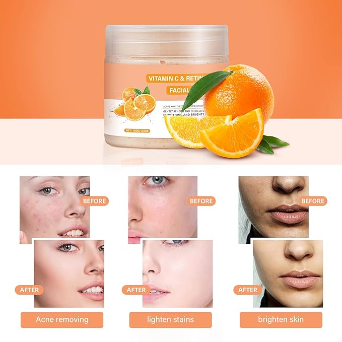 Vitamin C and Retinol Facial Scrub Face Scrubs Exfoliating Face Wash Vitamin C Facial Body Scrub Microdermabrasion Exfoliator for Blackhead Ingrown Hair KP Bump Eraser Exfoliant 3.5OZ