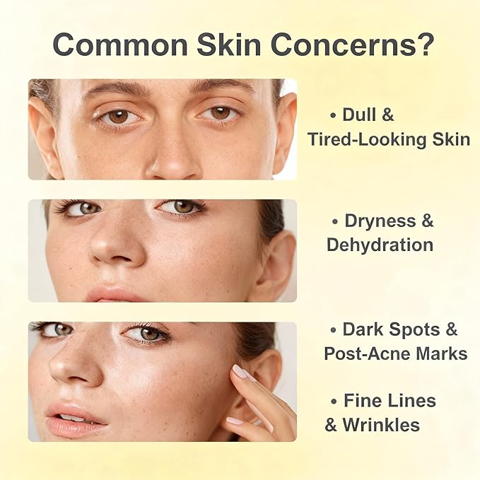 Vitamin C Face Serum with Niacinamide & Arbutin – Visibly Brightens Skin, Helps Reduce Dark Spots & Signs of Aging for a Radiant Glow – 30ml / 1.01 fl.oz. (1, 1)