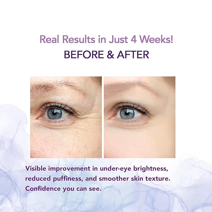 Caffeine Eye Cream for Dark Circles and Puffiness – Retinol Under Eye Brightening Cream for Wrinkles, Fine Lines, and Tired Eyes