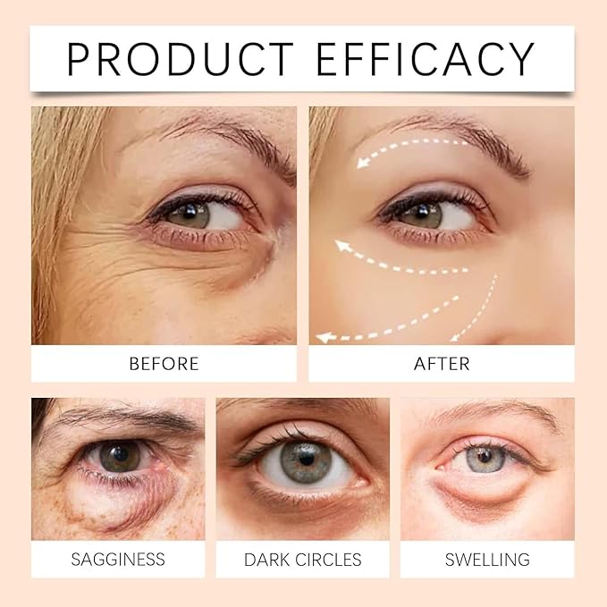 5d Peptides Anti-Aging Eye Repair Cream, 5d Peptide Anti-Wrinkle 𝐄ye 𝐂ream for Dark Circle & Puffiness (1pcs)