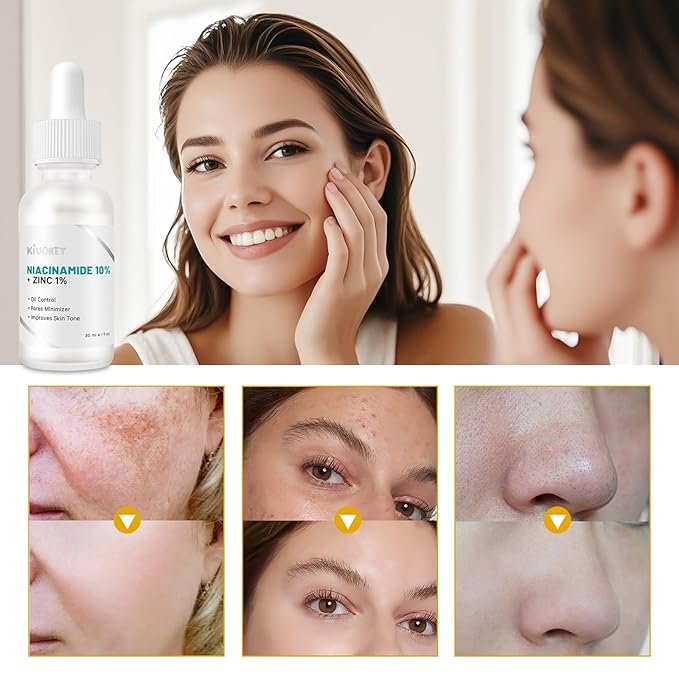 Niacinamide 10% + Zinc 1% Serum for Women - Niacinamide Serum for Face - Controls Oil, Shrinks Pores, Reduces Redness & Tones Skin - Deeply Hydrating, Gentle for All Skin Types
