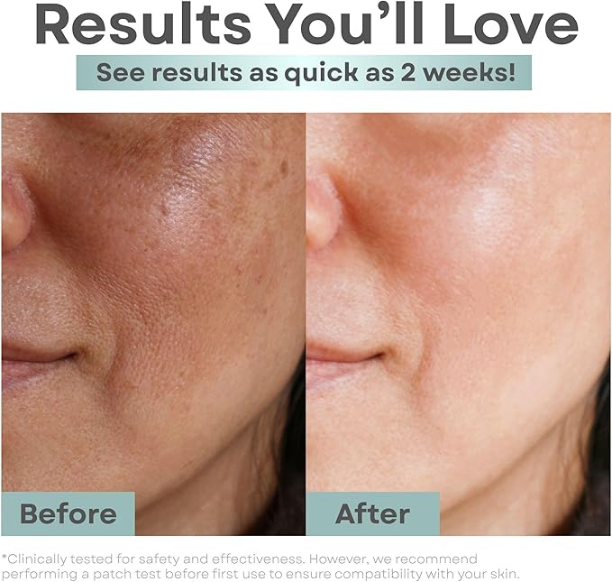 Clear Essence Anti Aging Toner Astringent with Alpha Hydroxy Acid, 8oz, Exfoliating Face Toner for Oily Skin, Acne Prone Skin, Pore Refining & Clarifying Toner for Women & Men, Hydrating Skin Care