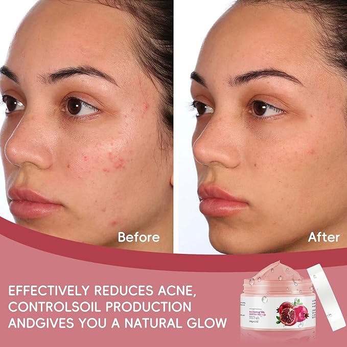 Clay Mud Face Mask for Women,Pomegranate Dead Sea Mud Facial Mask Skincare,Deeping Cleansing,Oil Control,Hydrating Face Cleaning Clay Masks for All Skin Types (4.2OZ)