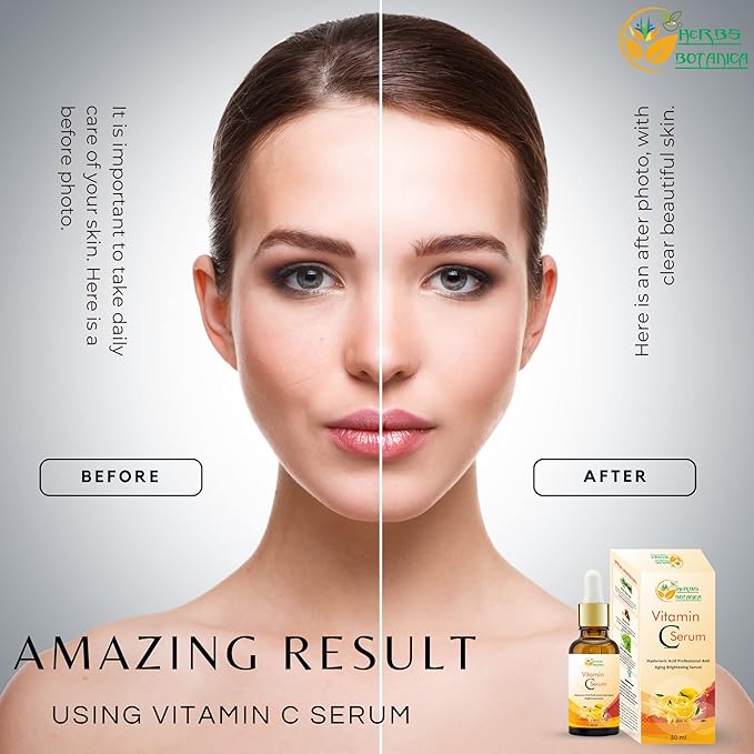 Herbs Botanica Vitamin C Serum For Face with Hyaluronic For Anti Aging Hydrating & Serum for Dark Spots, Fine Lines, Includes Vitamin E, Organic Aloe Vera and Jojoba Oil 1 fl oz