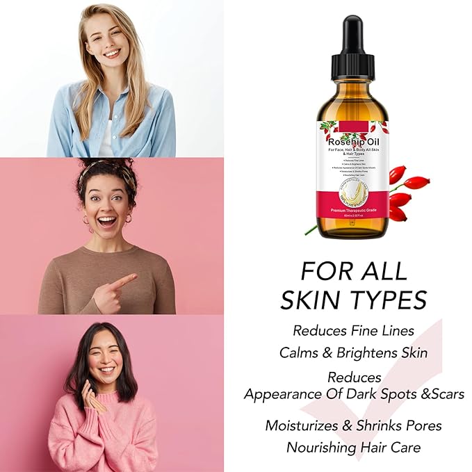 Rosehip Oil for Face, Rose Hip Oil Organic 100% Pure Cold Pressed for Anti-Aging, Nourishing Hair Care, Face & Skin (2.02 Fl Oz (Pack of 2))
