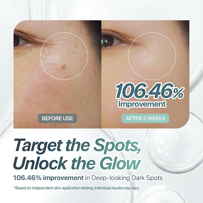 Charde Snow Ampoule Niacinamide Serum – Dark Spot Corrector & Brightening Serum for Face | 99.9% Pure Niacinamide + White Garcinia, Visible Results from First Use, Korean Skincare (1.01 fl oz)