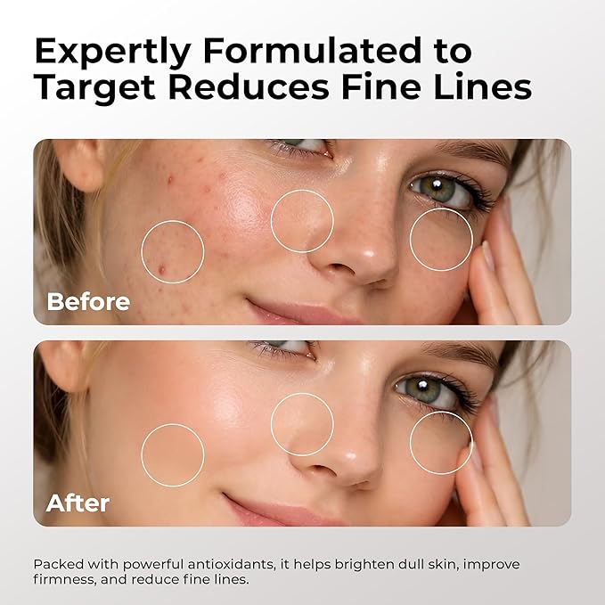 Skin Deva 10% Vitamin C Serum with Vitamin E & Ferulic Acid – Brightening Facial Serum with Hyaluronic Acid, Lightweight Formula for Even-Looking Skin - Pack of 2