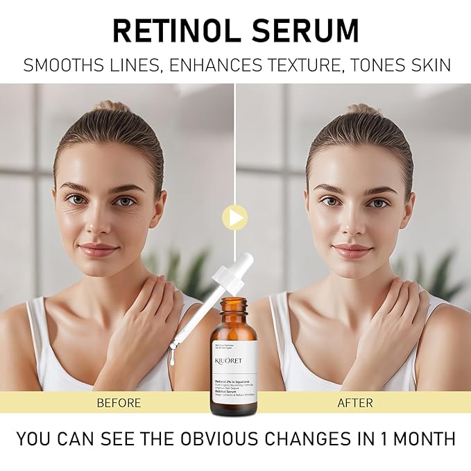 2% Retinol Serum for Face - Retinol 2% in Squalane for Reduce Wrinkles & Fine Lines - Improve Skin Tone with Hyaluronic Acid, Vitamin E & Niacinamide - Facial Serum for All Skins, 30ml