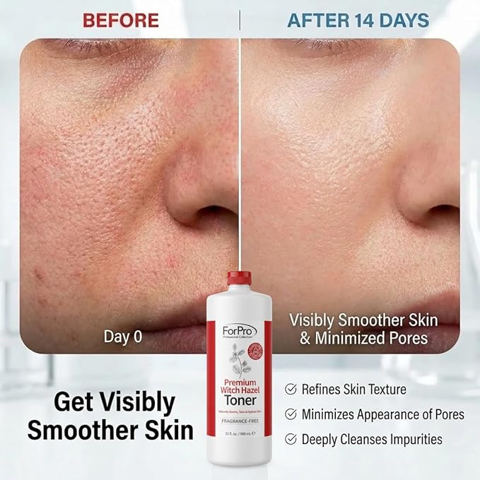 ForPro Witch Hazel Facial Toner with Aloe Vera & Glycerin, Alcohol-Free Face Toner for Sensitive Skin, Pore Minimizing, Hydrating & Soothing Cucumber Astringent, Fragrance-Free, Vegan, 32 Fl Oz