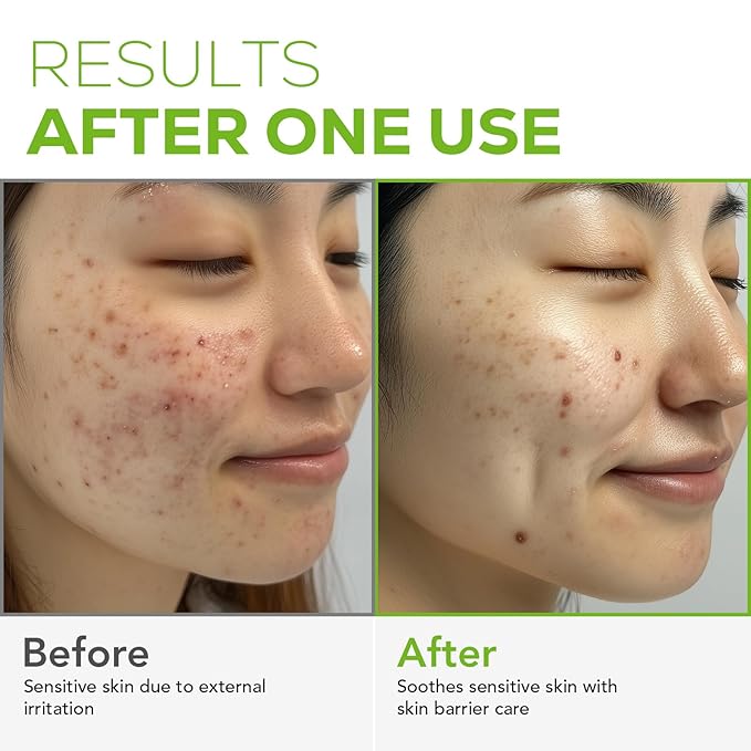 Olivia & Allison Hydrolyzed Collagen Serum 1.0 fl oz - With Panthenol + Hyaluronic Acid for Firming & Skin Barrier Supportv