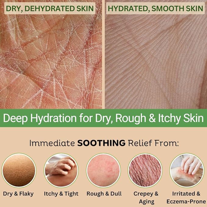 Natural Escapes Lemongrass Body Lotion & Hand Cream for Dry Skin, Firming Moisturizer for Crepey, Itchy & Sensitive Skin, with Coconut Oil, Olive Oil & Ceramides, 8 oz