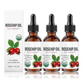 Rosehip Oil for Face, Rosehip Seed Oil, Organic Face Oil for Women, Hydrating Facial Oil for Daily Skincare, Nourishing Skin & Hair, Lightweight Moisturizing Oil (3PC)