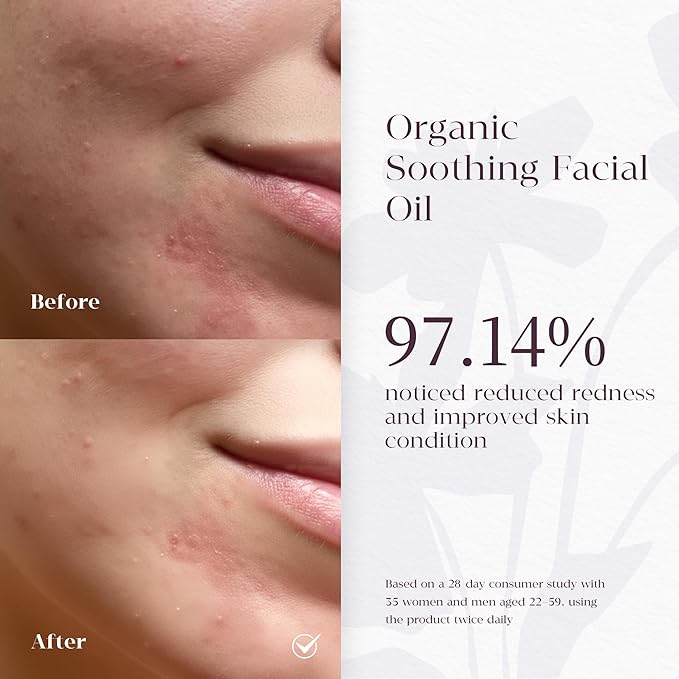 Organic Barrier Repair Face Serum – Brightening, Firming & Hydrating Serum for Dry & Sensitive Skin | Soothes Redness & Dryness | with Niacinamide, Vitamin E & Camelina Seed Oil