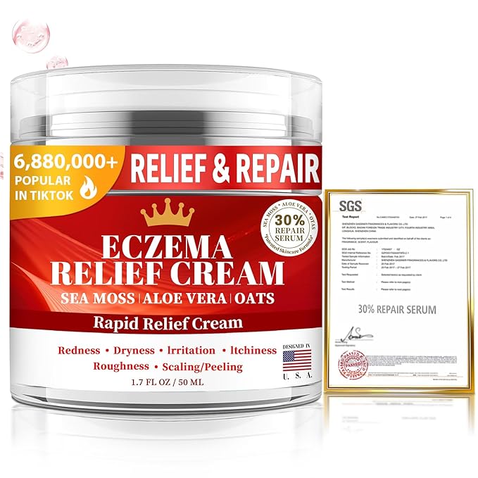 Eczema Cream for Kids & Adults - Eczema Relief Cream for Redness, Itchy, Dry Skin, Daily Moisturizer for Sensitive Skin, with Sea Moss, Aloe Vera, Colloidal Oatmeal (1.7 Fl Oz (Pack of 1))