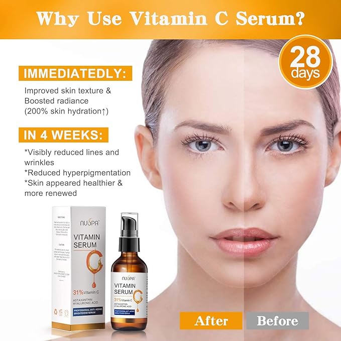 Vitamin C Serum for Face 2oz 31% Vitamin C Facial Moisturizer Anti Aging Reduces Age Spots and Sun Damage Natural Brightening Serum with Hyaluronic Acid and Astaxanthin