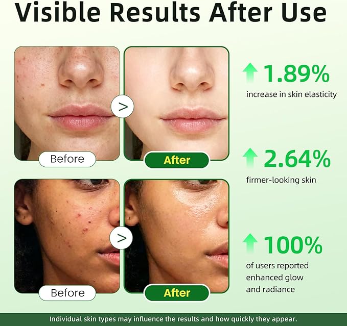 Vitamin C Serum for Face, 20% Brightening Face Serum with Sodium Hyaluronate for Dark Spots & Fine Lines – Support Collagen & Skin Radiance, Plus Vit C Caps for Inside-Out Support, 1 Fl Oz + 60 Caps