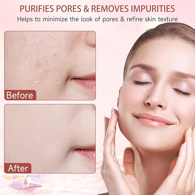 Purifying Exfoliating Gel, Facial Exfoliator Cleanser, Face Scrub, Natural Exfoliating Gel Purifying Cream, Gentle for Face Body, Deep Cleansing for All Skin (2PCS)