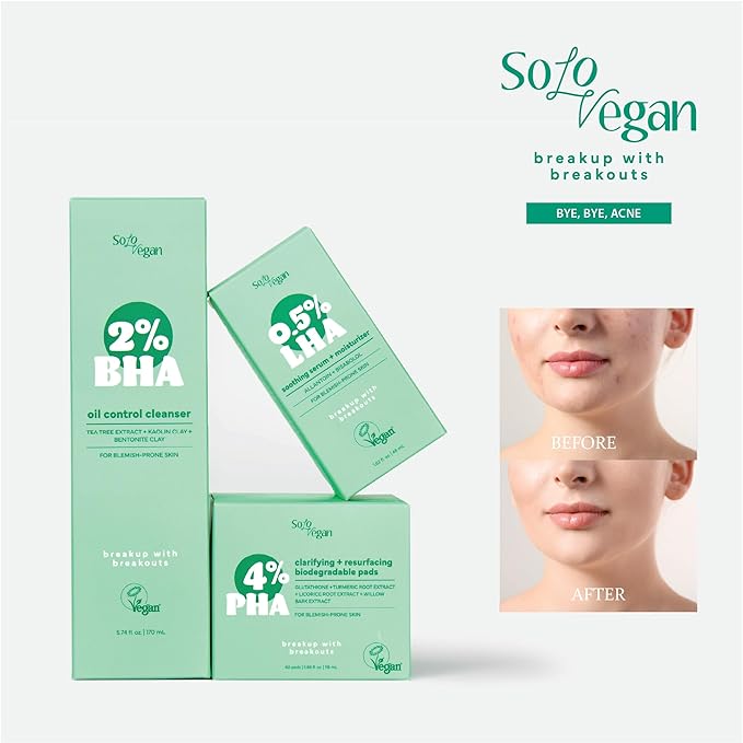 SoloVegan BHA Gel Cleanser | Lightweight, Vegan Korean Skincare for Oily, Acne-Prone Skin (Cleansing Gel, 5.74 fl.oz)