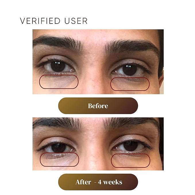 PLANTKOS Revitalizing Eye Cream