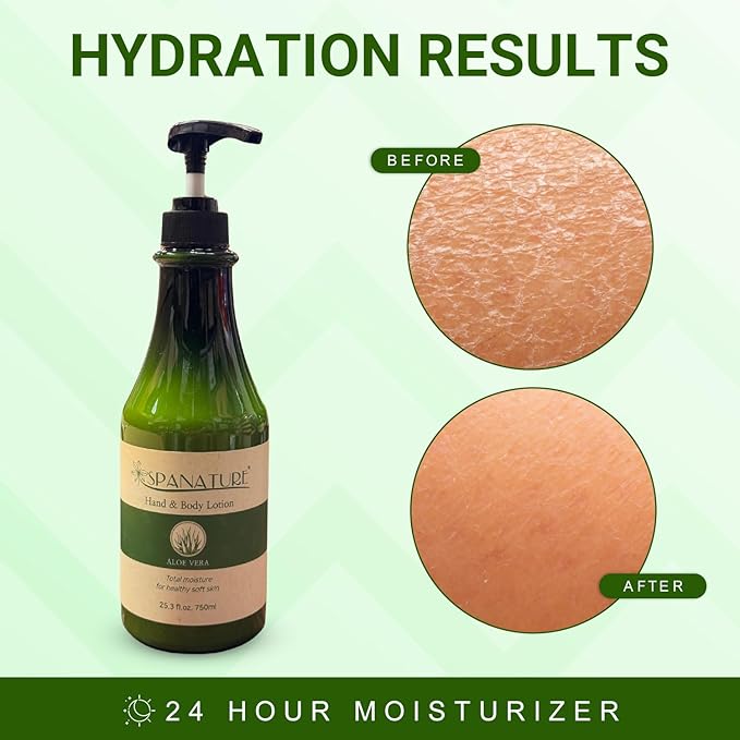 Spanature Premium Aloe Vera Body Lotion for Women Sunburn Relief - Soothing Aloe Lotion & Body Moisturizer for Dry Skin-Natural Healing & Soothing Therapy -750ml/25oz with Pump, Made in Korea