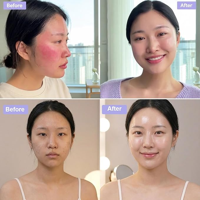 Madecassoside Sheet Mask Blemish Repair, Centella Face Mask- Hyaluronic Acid, Niacinamide, Panthenol Facial Masks for Soothing, Hydrating, Glow, SkinCare, 5ea Easter Basket Stuffers