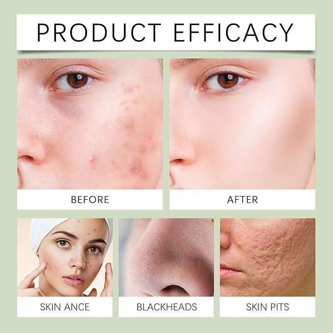 Mung Bean Foam Cleanser, pH-Balanced Purifying Face Wash, Gently Cleanses Excess Oil & Dirt for Smooth, Refreshed Skin, Daily Facial Cleanser for Oily & Combination Skin