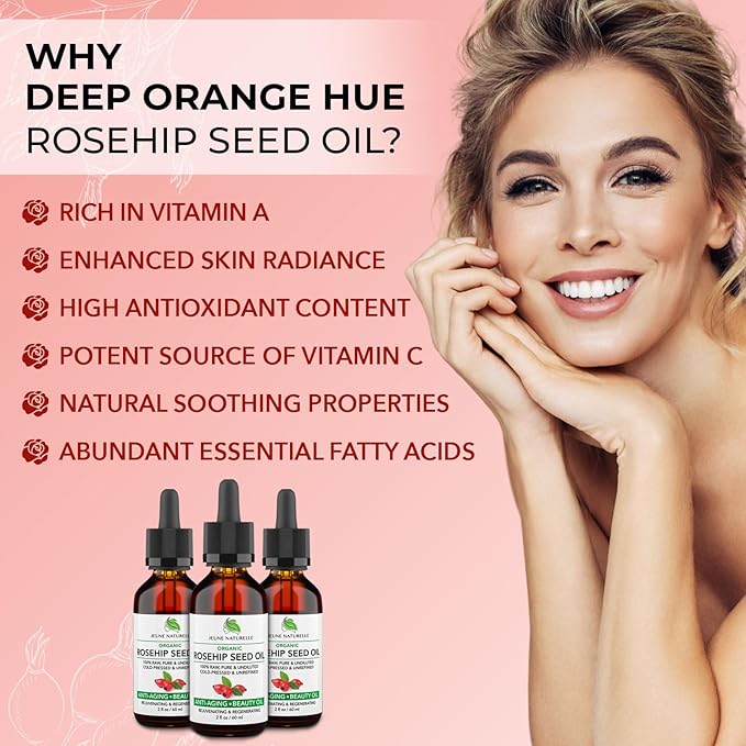 Jeune Naturelle Rosehip Oil - Pure, Virgin, Cold Pressed - From Whole Berries (Pulp & Seeds), Natural Deep Orange Hue for Intensive Skin Repair - Undiluted Organic Rosehip Seed Oil, 2 oz