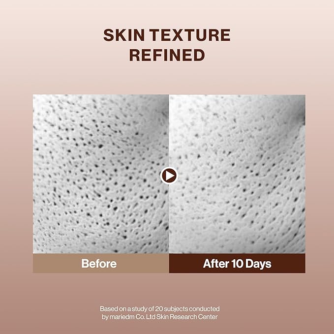 BEIGIC Treatment Essence - Hydrating Face Essence for Radiance & Smooth Skin Texture with Vegan Peptides & Niacinamide for Glass Skin (4.05 Fl. Oz)