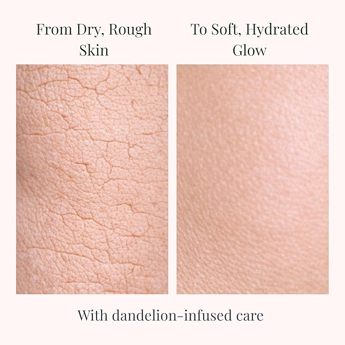 Body Lotion – Deep Hydrating Botanical Moisturizer with Dandelion Oil, Plant-Based Lotion for Dry & Sensitive Skin, 8 oz