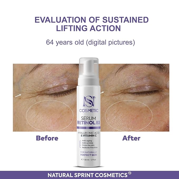 Anti Aging Face Serum with Retinol, Vitamin C, Vitamin B3 & Hyaluronic Acid – Deep Hydration, Collagen Boost, Wrinkle Reduction & Skin Firming – Lightweight Formula – 50 ml