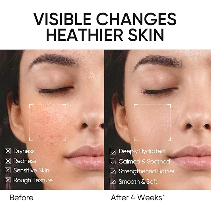SKINTIFIC Face Moisturizer with 5X Ceramides, Hydrating Moisture Barrier Repair Cream for Sensitive/Oil Skin Types, Hyaluronic Acid & Centella, Daily Facial Moisturizer, Non-Comedogenic 30g/1 fl.oz