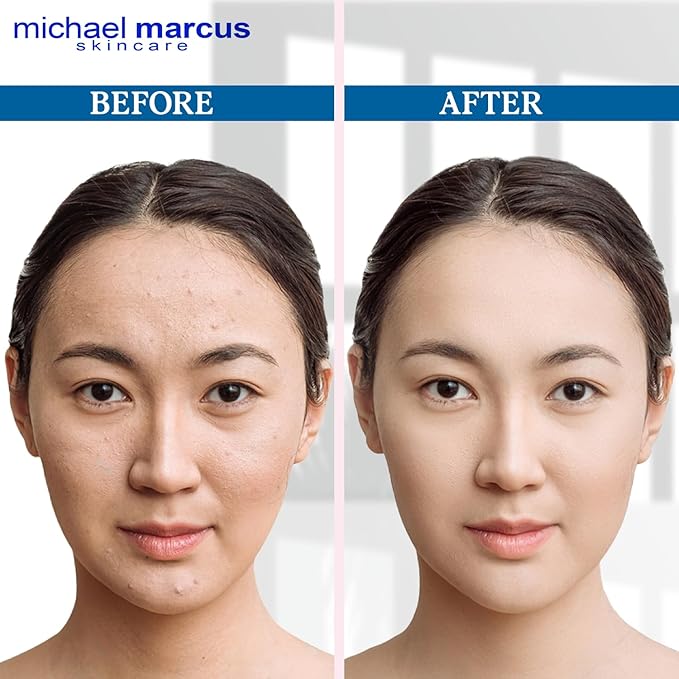 Michael Marcus Exfoliating Enzyme Face Peel (1.7oz Jar) - Face Exfoliator Mask for Dullness, Fine Lines, Wrinkles & Uneven Skin Tone - Remove Impurities and Unclog Pores with Cruelty Free skincare