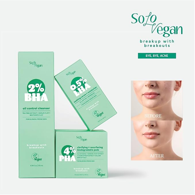 SoloVegan LHA Serum + Moisturizer | Hydrating, Moisturizing, Vegan Korean Skincare for Sensitive, Acne-Prone Skin (Facial Serum, 1.62 fl.oz)