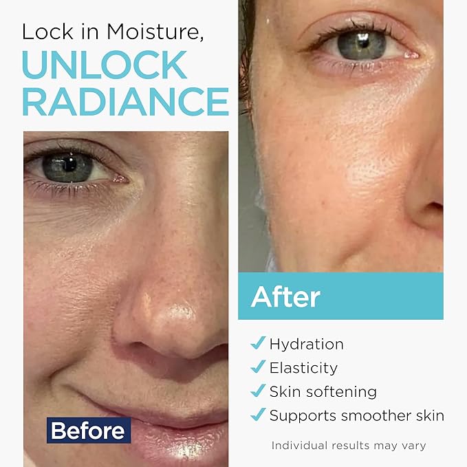 Hyaluronic Acid Serum for Face (1 Oz) for Skin and Lips - Hydrating & Moisturizing Serum for All Skin Types, Paraben-Free & Fragrance-Free