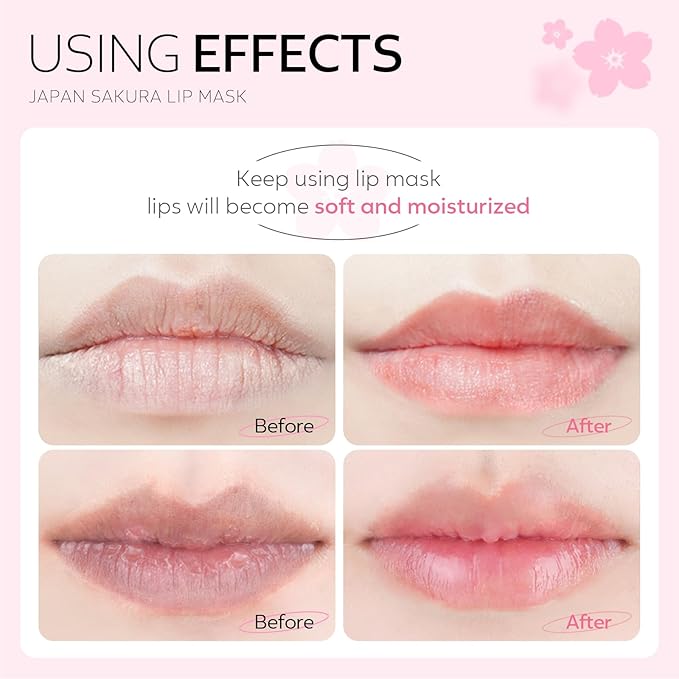 AKARY Sakura 10 Pieces Hydrating Lip Mask, Lip Sleep Mask Collagen Crystal Lip Care Gel Pads For Moisturizing, Minimize Fine Lines, Remove Dead Skin, Chapped Pads Lip Mask (10)