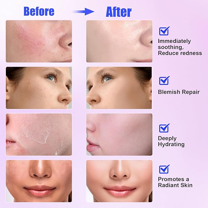 Madecassoside Sheet Mask Blemish Repair, Cica Face Mask korean Skin Care for Sensitive Skin - Hyaluronic Acid, Niacinamide, Centella Facial Masks for Soothing, Hydrating, Glow 10ea Easter Gifts