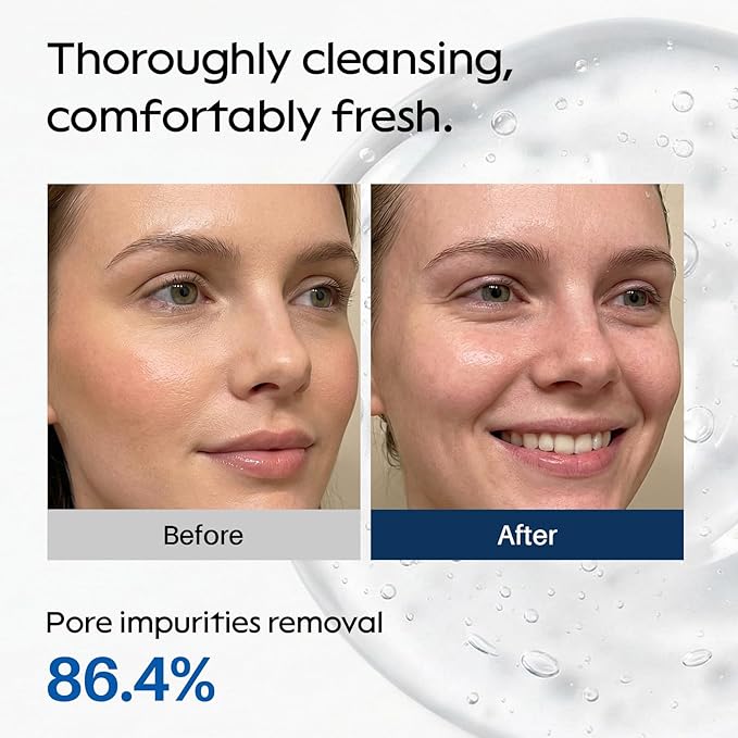 SPODARE Pure Cleansing Oil, Natural Oil Cleanser for Face, 6.76 fl oz Makeup Blackhead Remover, Facial Cleansing Oil for All Skin Types - 200ml