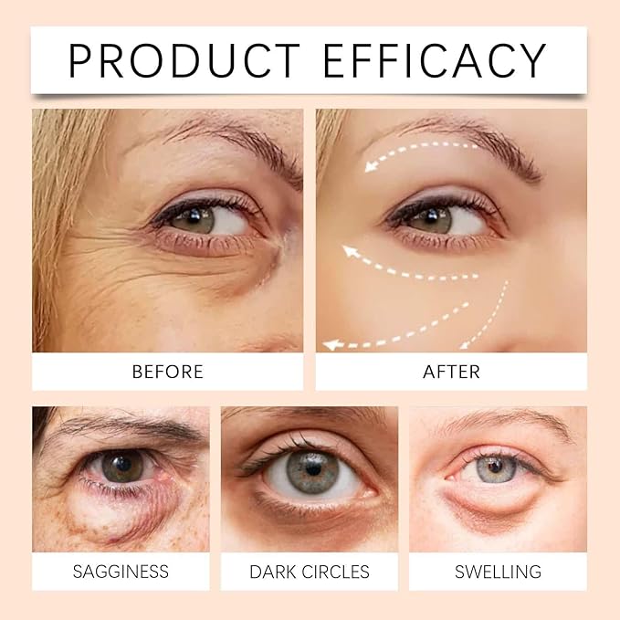 5D Peptide Anti-Wrinkle Eye Cream, Anti-Wrinkle Firming Eye Cream, 5D Peptide Anti Aging Eye Cream, Peptide Lifting Eye Gel, For Dark Circles and Puffiness (3pcs)