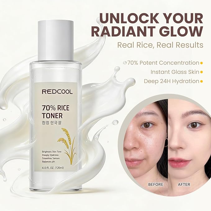 Rice Toner & Serum for Face, 70% Rice Water Skin Care Toner, Lightweight Face Toner for Women, Hydrating Facial Toner for Daily Layering, 120ml / 4.0 fl oz