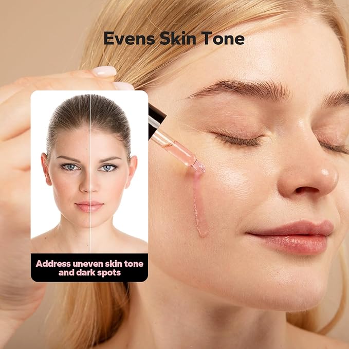 SilkyShark Niacinamide Serum (1 Fl Oz), 10% Niacinamide + 4% Tranexamic Acid Serum, Face Serums for Pore Minimizing, Dark Spots, Blackhead Removal, Hydrating, and Anti-Aging