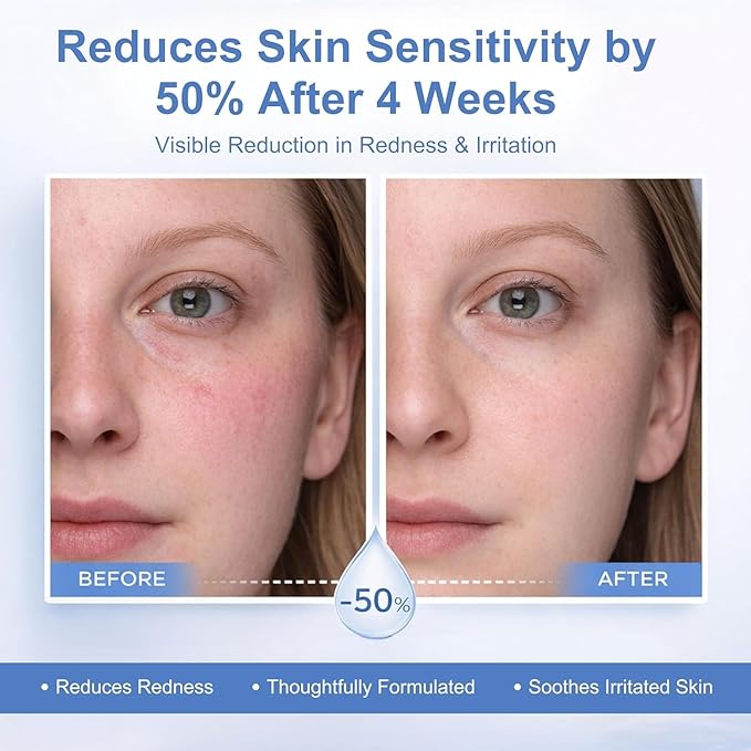 Korean Relief Moisturizer with Ceramides – 120H Lasting Hydration with Ceramide Capsules – Barrier Repair for Dry & Sensitive Skin, Non-Comedogenic – 80 mL / 2.70 fl oz (Unscented)
