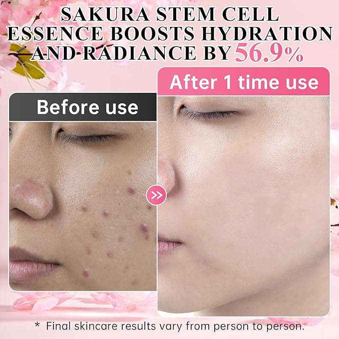 Sakura stem cell serum for face - with Hyaluronic Acid, Niacinamide & vitamin c Facial Serum for Restore smooth skin & Anti Aging & Cell renewal & Enhance skin elasticity, ultra hydrating serum 20 pcs