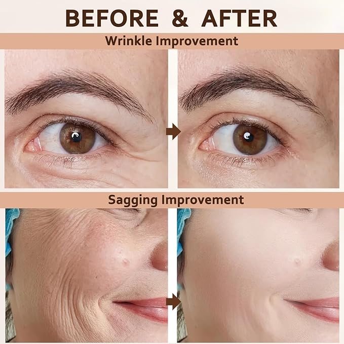 Silk Peptide Intensive Lifting Ampoule - Deep Collagen Silk Peptide Intensive Lifting Ampoule Serums for Face Tightening and Lifting, Korean Anti Aging Face Serum for Women 1.7fl.Oz/50ml (1pc)